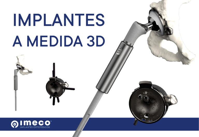 Planificación Alsina+IMPLANTES A MEDIDA-01